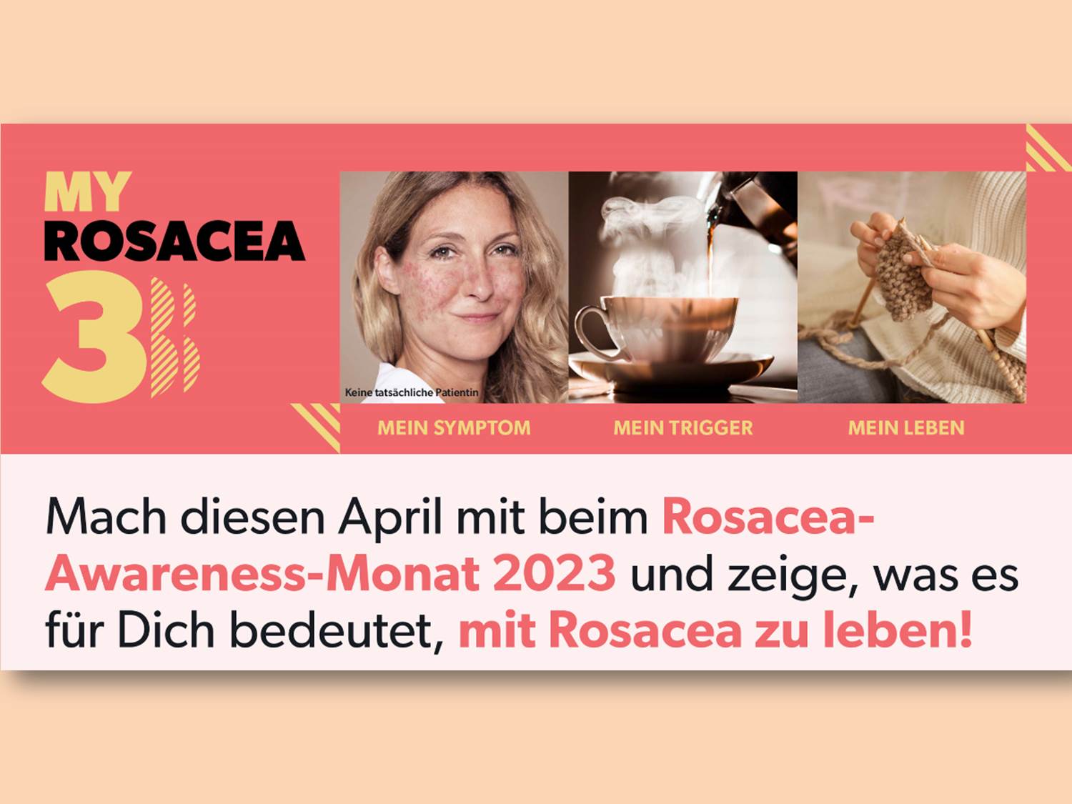 #MyRosacea3 – Mein Symptom, mein Trigger, mein Leben. Social Media Kampagne von Galderma im Rosacea-Awareness-Monat 2023. (Bildrechte: Galderma Laboratorium GmbH)