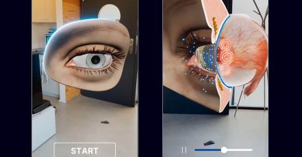 Bild: URSAPHARM Augmented Reality-App